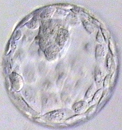 Blastocyst Transfer